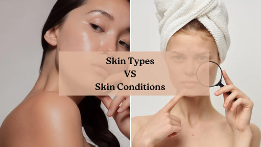 Skin Types VS Skin Conditions