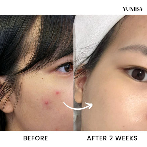 Radiant Results: Achieve Glowing Skin in Just 2 Weeks!