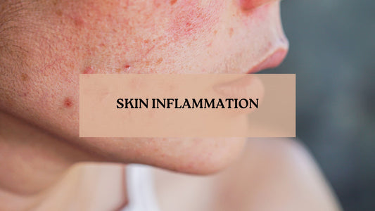 Everything You Need to Know About Skin Inflammation